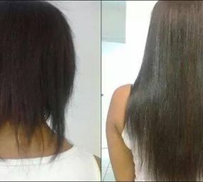 Clínica Martha Hair photo 5