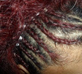 Estética Telinha Fashion Hair  photo 6