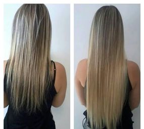 Clínica Martha Hair photo 4