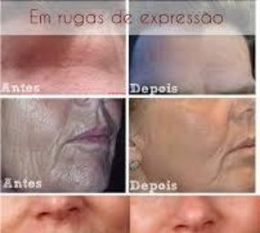 Infinity Massoterapia Estética Corporal e Facial photo 6