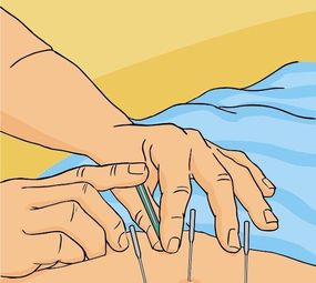 Studio de Acupuntura e Bem-estar photo 1