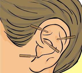 Studio de Acupuntura e Bem-estar photo 3