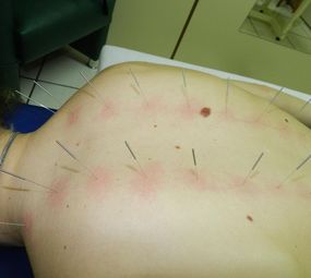 Clínica de Acupuntura e Quiropraxia photo 4