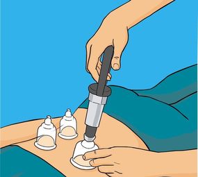 Studio de Acupuntura e Bem-estar photo 4